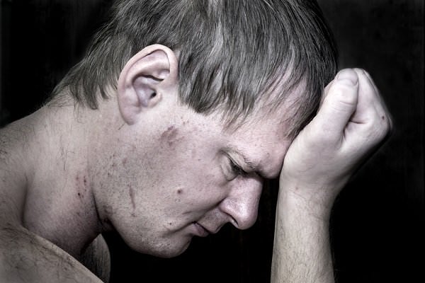 Fentanyl withdrawal can cause massive pain and discomfort. (Oksana Mizina/Shutterstock)